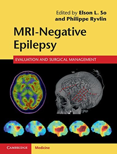 MRI-Negative Epilepsy: Evaluation and Surgical Management (English Edition)