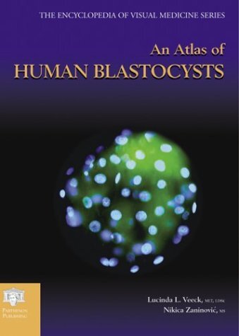 Atlas of Human Blastocysts (Encyclopedia of Visual Medicine Series Book 59) (English Edition)