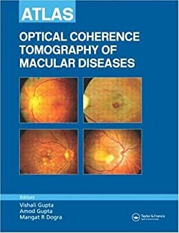 Atlas Optical Coherence Tomography of Macular Diseases (English Edition)