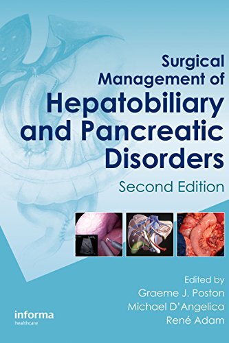 Surgical Management of Hepatobiliary and Pancreatic Disorders (English Edition)