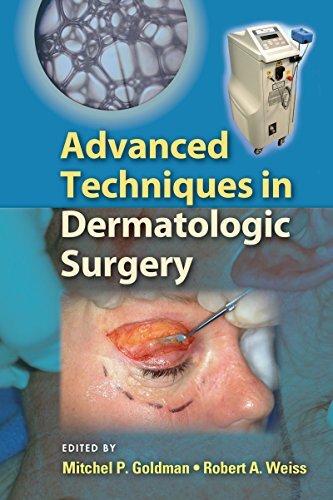 Advanced Techniques in Dermatologic Surgery (Basic and Clinical Dermatology Book 35) (English Edition)