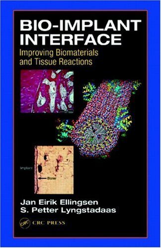 Bio-Implant Interface:  Improving Biomaterials and Tissue Reactions (English Edition)