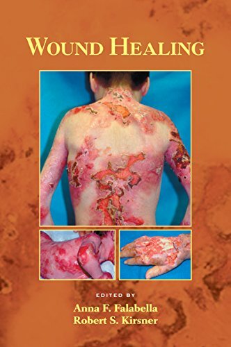 Wound Healing (Basic and Clinical Dermatology Book 33) (English Edition)