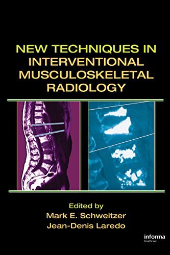 New Techniques in Interventional Musculoskeletal Radiology (English Edition)