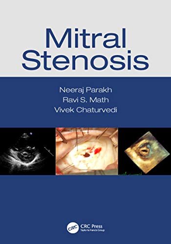 Mitral Stenosis (English Edition)