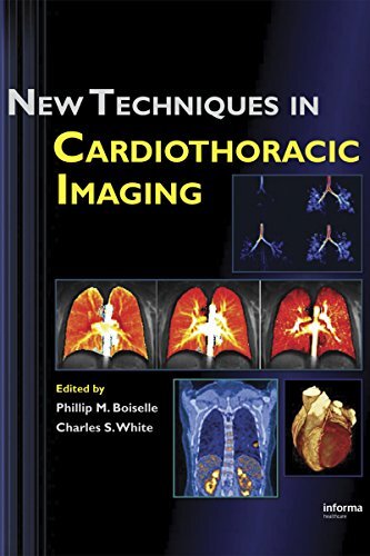 New Techniques in Cardiothoracic Imaging (English Edition)