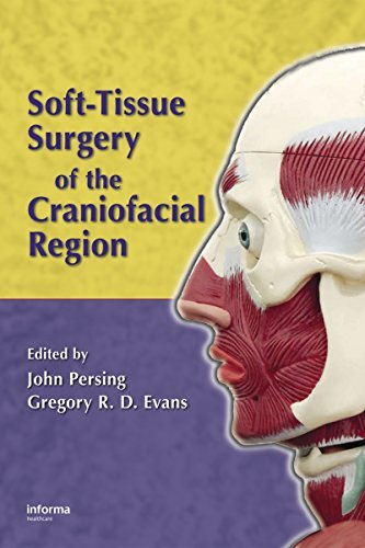 Soft-Tissue Surgery of the Craniofacial Region: A Practical Guide (English Edition)