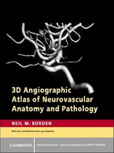 3D Angiographic Atlas of Neurovascular Anatomy and Pathology (English Edition)