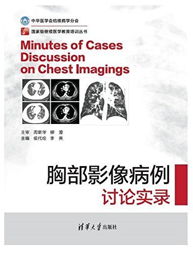 国家级继续医学教育培训丛书:胸部影像病例讨论实录