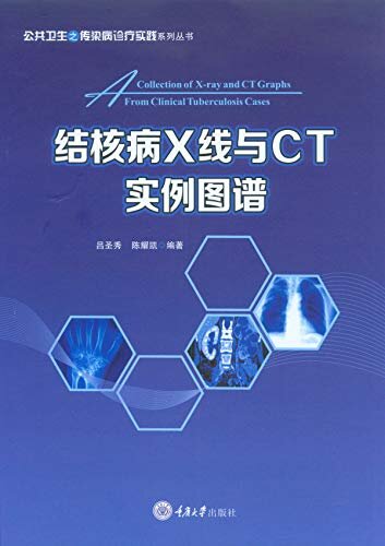 结核病X线与CT实例图谱