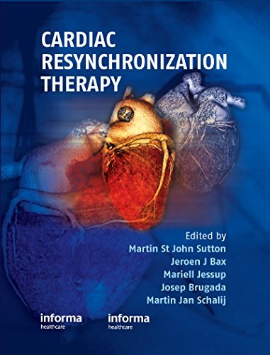 Cardiac Resynchronization Therapy (English Edition)