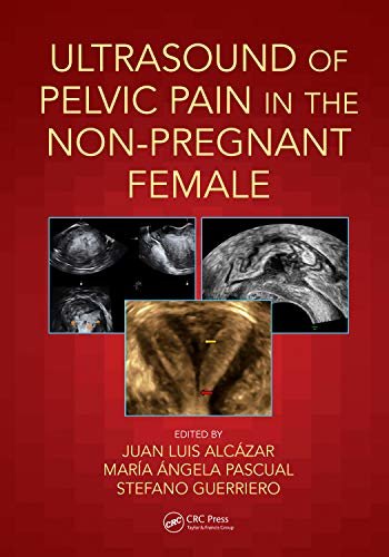 Ultrasound of Pelvic Pain in the Non-Pregnant Patient (English Edition)