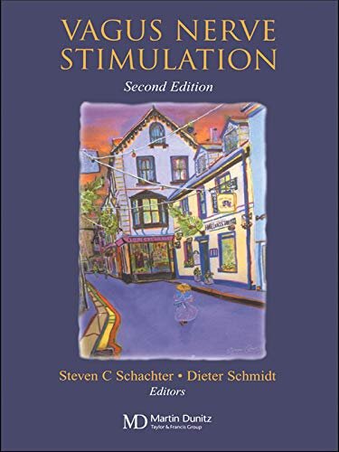 Vagus Nerve Stimulation (English Edition)