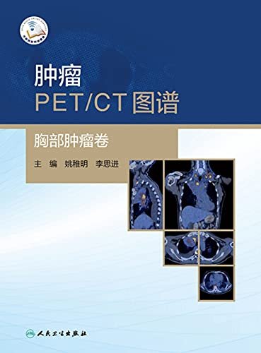 肿瘤PET／CT图谱——胸部肿瘤卷