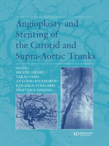 Angioplasty and Stenting of the Carotid and Supra-Aortic Trunks (English Edition)