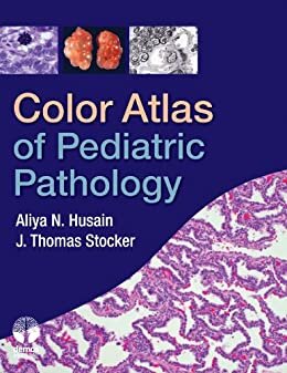 Color Atlas of Pediatric Pathology (English Edition)