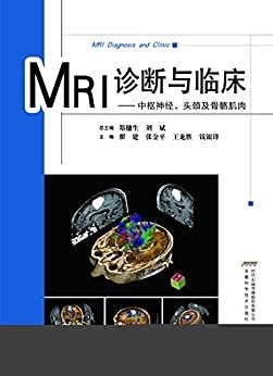 MRI诊断与临床:中枢神经、头颈及骨骼肌肉