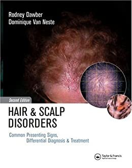Hair and Scalp Disorders: Common Presenting Signs, Differential Diagnosis and Treatment (English Edition)