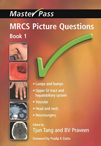 MRCS Picture Questions: Bk. 1 (MasterPass) (English Edition)