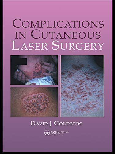 Complications in Laser Cutaneous Surgery (English Edition)
