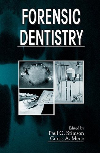 Forensic Dentistry (English Edition)