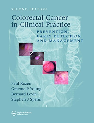 Colorectal Cancer in Clinical Practice: Prevention, Early Detection and Management, Second Edition (English Edition)