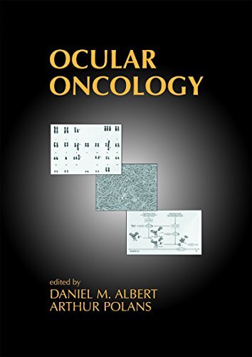 Ocular Oncology (English Edition)