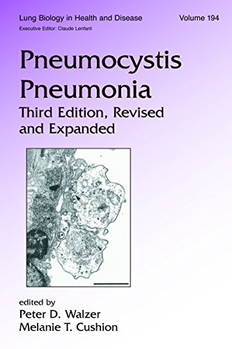 Pneumocystis Pneumonia (Lung Biology in Health and Disease Book 194) (English Edition)