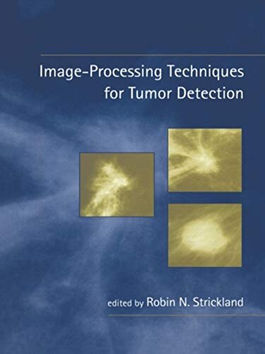 Image-Processing Techniques for Tumor Detection (English Edition)