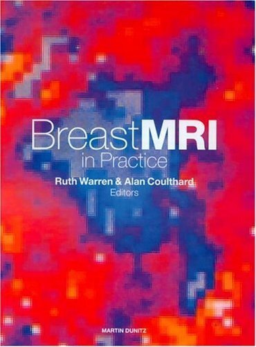 Breast MRI in Practice (English Edition)