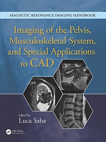 Imaging of the Pelvis, Musculoskeletal System, and Special Applications to CAD (Magnetic Resonance Imaging Handbook) (English Edition)
