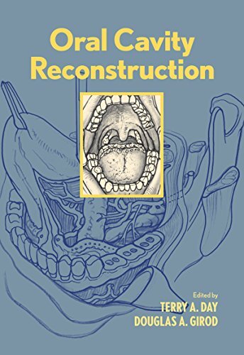 Oral Cavity Reconstruction (English Edition)