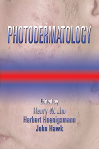 Photodermatology (Basic and Clinical Dermatology Book 38) (English Edition)