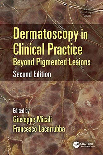 Dermatoscopy in Clinical Practice: Beyond Pigmented Lesions (Series in Dermatological Treatment Book 8) (English Edition)