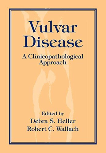 Vulvar Disease: A Clinicopathological Approach (English Edition)