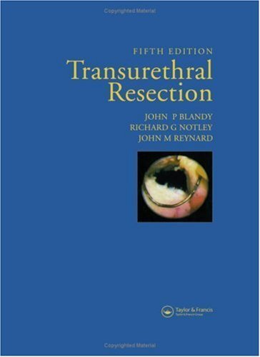 Transurethral Resection (English Edition)
