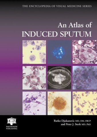 Atlas of Induced Sputum (Encyclopedia of Visual Medicine Series Book 69) (English Edition)