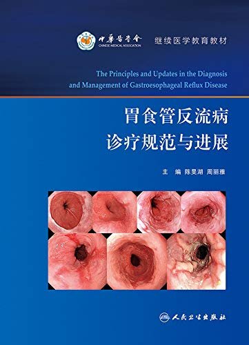 胃食管反流病诊疗规范与进展
