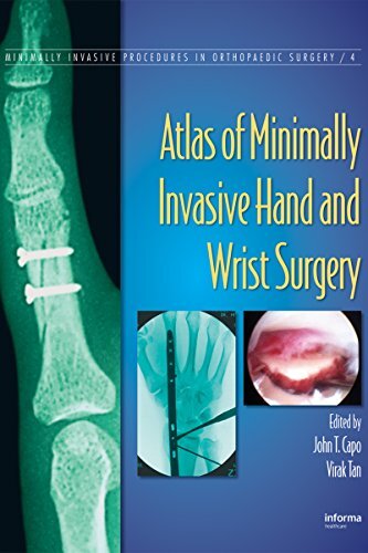 Atlas of Minimally Invasive Hand and Wrist Surgery (Minimally Invasive Procedures in Orthopaedic Surgery Book 4) (English Edition)
