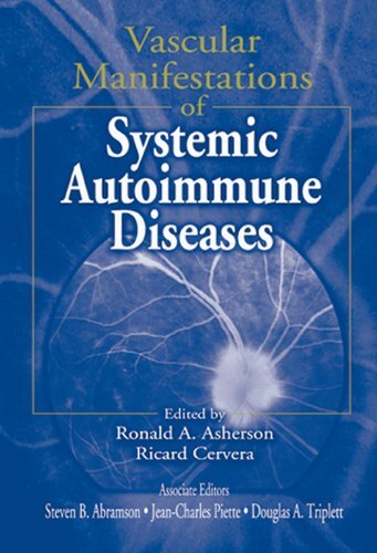 Vascular Manifestations of Systemic Autoimmune Diseases (English Edition)