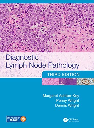 Diagnostic Lymph Node Pathology (English Edition)