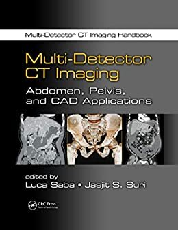 Multi-Detector CT Imaging: Abdomen, Pelvis, and CAD Applications (English Edition)