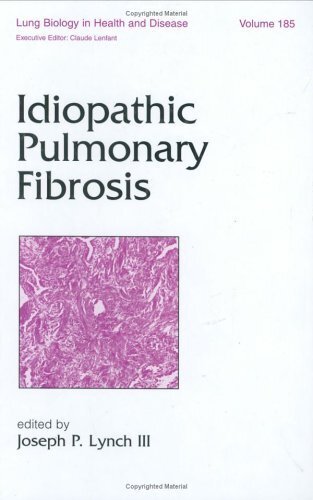 Idiopathic Pulmonary Fibrosis (English Edition)