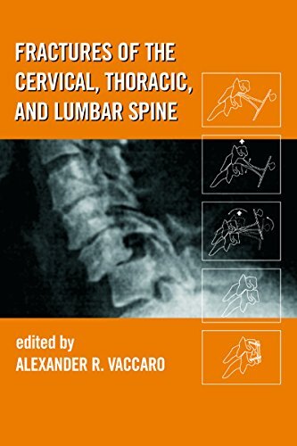 Fractures of the Cervical, Thoracic, and Lumbar Spine (English Edition)