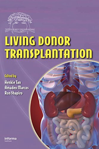 Living Donor Transplantation (English Edition)