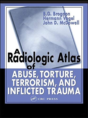 A Radiologic Atlas of Abuse, Torture, Terrorism, and Inflicted Trauma (English Edition)