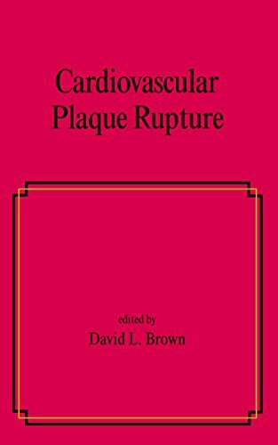 Cardiovascular Plaque Rupture (Fundamental and Clinical Cardiology Book 45) (English Edition)