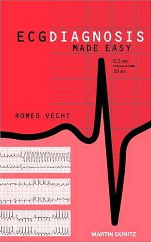 ECG Diagnosis Made Easy (English Edition)