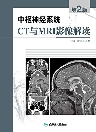 中枢神经系统CT和MRI影像解读（第2版）