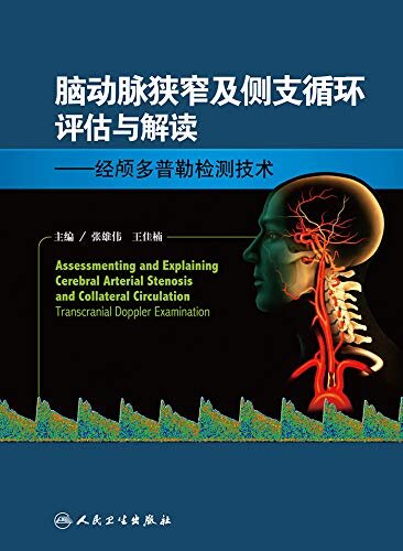 脑动脉狭窄及侧支循环评估与解读——经颅多普勒检测技术